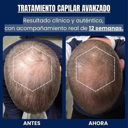 Alfagrow - Fórmula Avanzada de Péptidos de Cobre para el Crecimiento Capilar